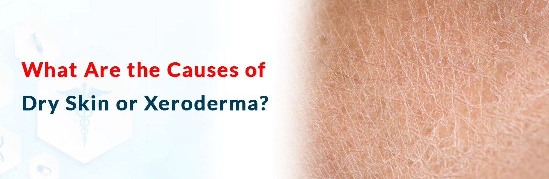  What Are the Causes of Dry Skin or Xeroderma?